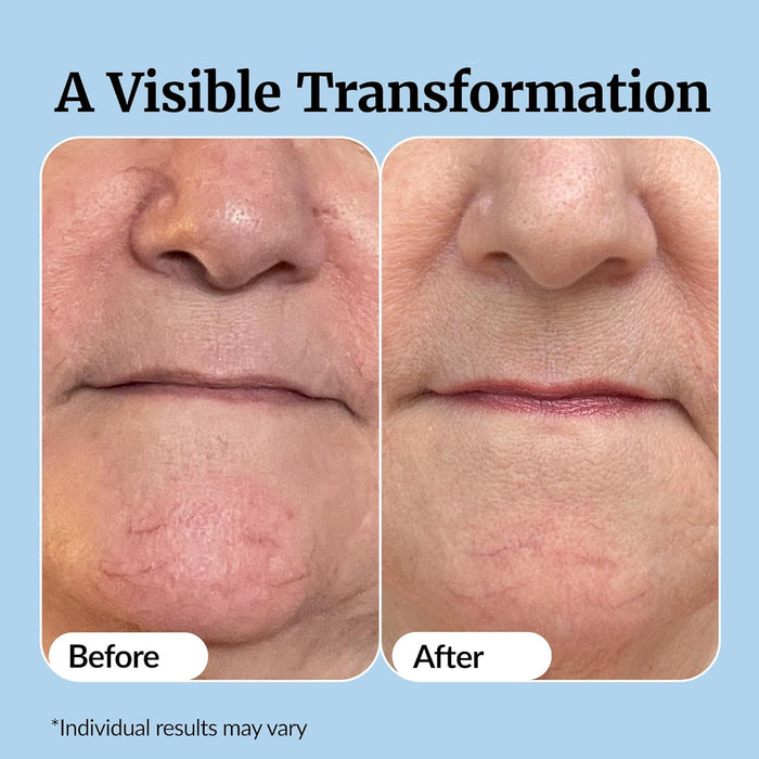 Vibriance Super C Serum para piel madura - Fórmula vitamínica todo en uno hidrata, reafirma, levanta, suaviza, se dirige a manchas de la edad, arrugas, 1 onza líquida